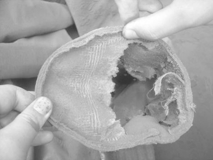 生物質鍋爐除塵器運行阻力高怎么排除原因 生物質鍋爐除塵器運行阻力高怎么排除原因